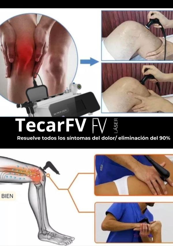 TecarFV - Imagen 4